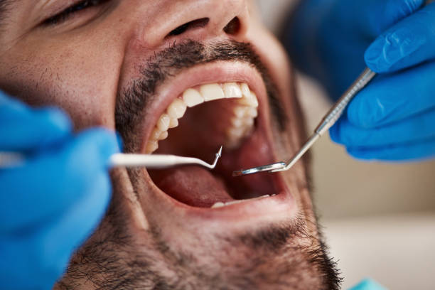 Best Emergency Dental Services for Seniors in Blacksburg, VA