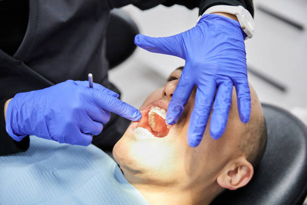 Best Emergency Dentist for Lost Fillings or Crowns in Blacksburg, VA